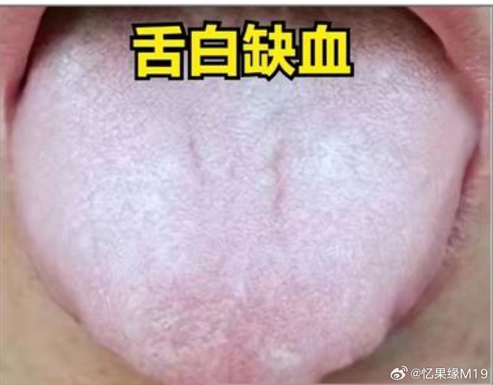 img-17356316436321e56db2864759b12c24f3159b3367b7430c403ac44bbf6eb507754cb8ec09ef3.jpg